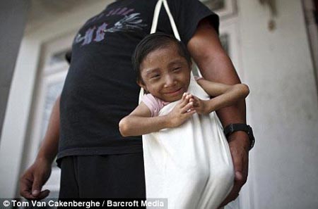 El hombre mas pequeño del mundo en Nepal