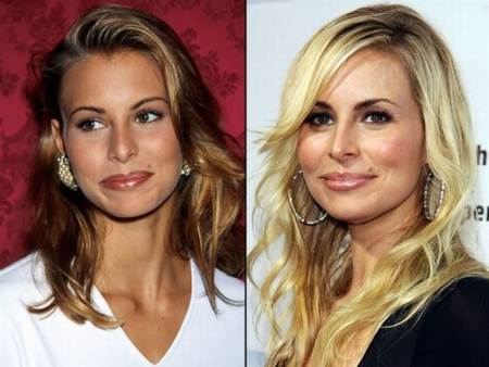 Niki Taylor antes y despues