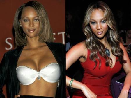 Tyra Banks antes y despues